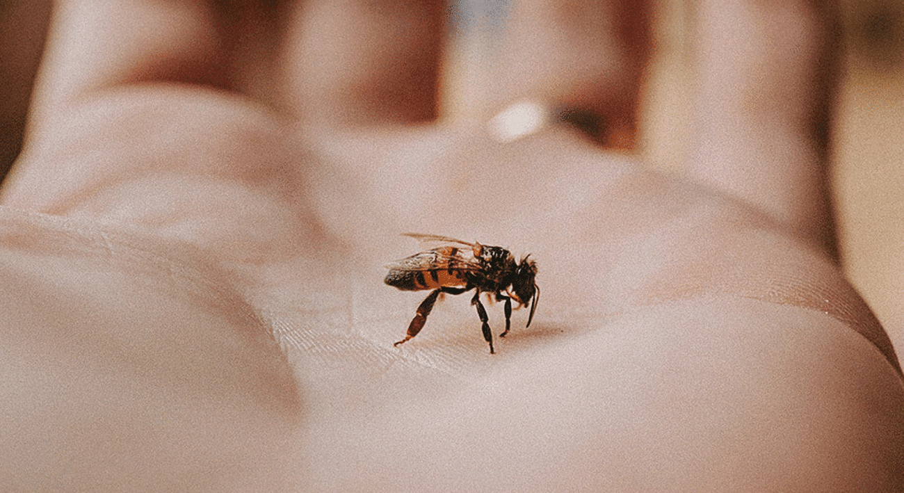 Народний метод чи аптека? Як правильно діяти після укусу бджоли